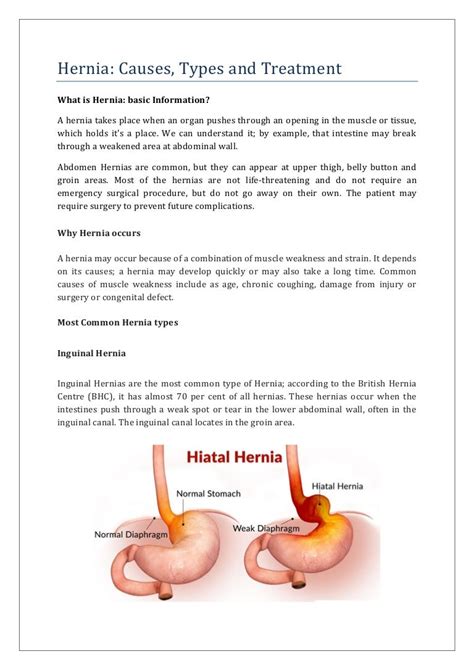 Hernia Causes Types And Treatment