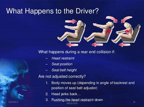 Railway Spine And Whiplash Injury