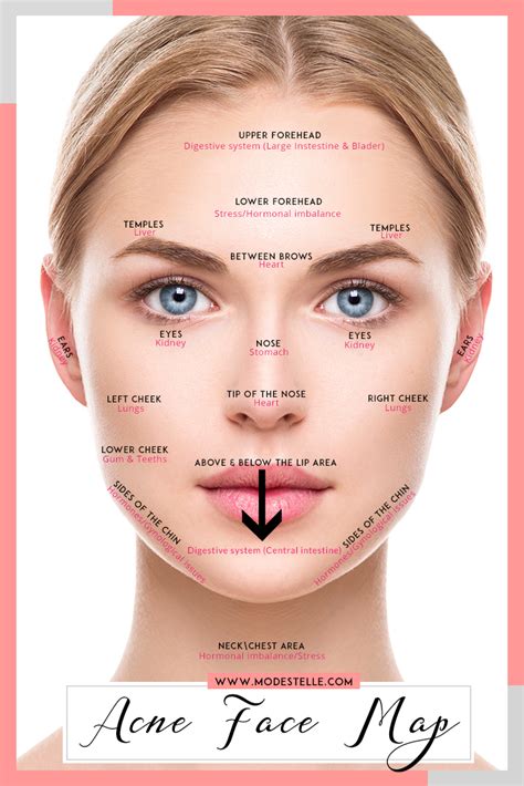 Face Mapping Acne Chinese Causes And Remedies Of Acne Artofit