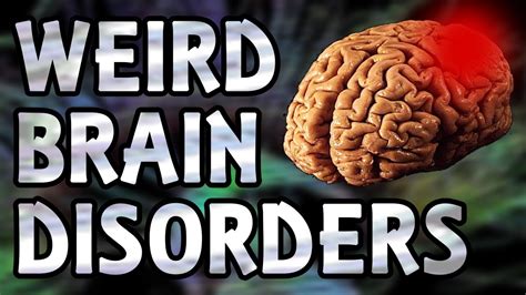 Top 5 Weird Brain Disorders The Mind Voyager