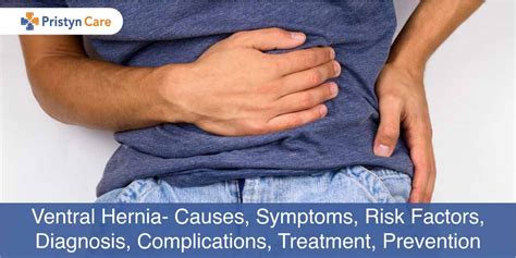 Incisional Hernia Symptoms And Signs Vrogue Co