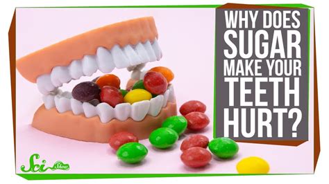 Why Does Sugar Make My Teeth Hurt Youtube