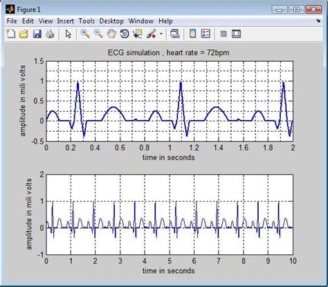 The Journal Ecg Simulation Using Matlab A Mathematical Approach