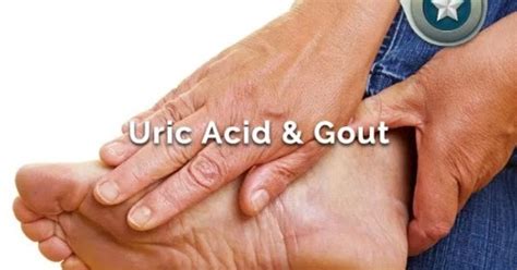 Uric Acid Signs Causes Symptoms And Treatment Healthy Solutions