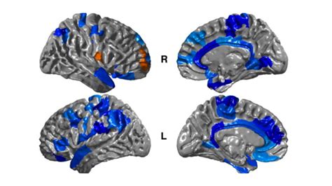 Crossfit Why Your Brain Needs Fat