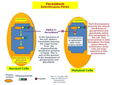 Fucosidosis Hereditary Ocular Diseases