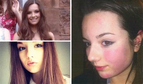 Emily Drouet Teen Shares Selfie Of Battered Face From Abusing Lover