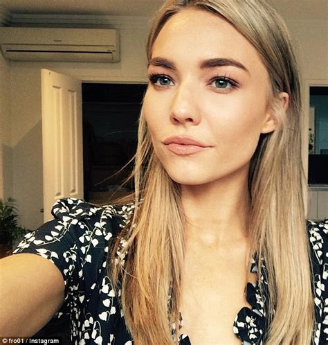 Home And Away Star Sam Frost Shares Image Of Her Brutal Black Eye Injury Daily Mail Online