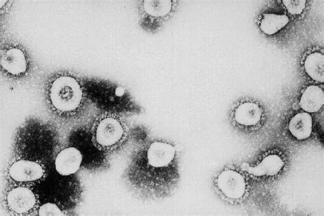 Photos Sars Outbreak Of 2003 In Pictures