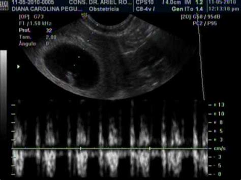 We did not find results for: EMBARAZO DE 6 SEMANAS . DR ARIEL RODRIGUEZ, UNION MEDICA ...