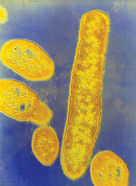 Gut Bacteria May Play A Role In Autism Scientific American