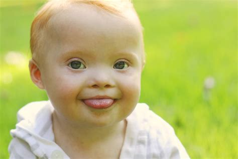 Chromosomes are small packages of genes in the body. How Cervical Spine Injuries are Managed in Children