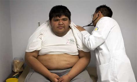 fat city the obesity crisis that threatens to overwhelm mexico s capital cities the guardian
