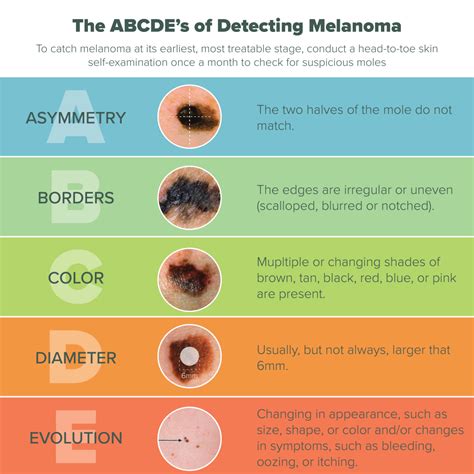 Guide In Detecting Signs Of Skin Cancer Rcoolguides