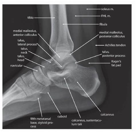 Foot Radiograph Anatomy
