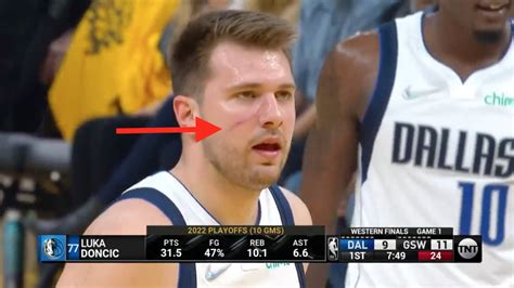 Video Luka Doncic Gets Faced Scratched In Game 1