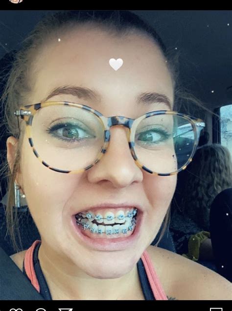 adult braces braces girls shoe room brace face girl g perfect teeth girls with glasses