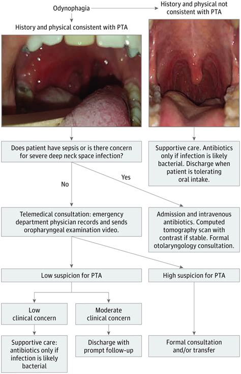 Utility Of Smartphone Telemedical Consultations For Peritonsillar