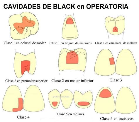 Odontoinformate