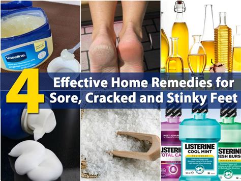 Because of an incident at school, she gets to know the older brother of one of the students zhang zheng lan, who is the boss of a games company. 4 Effective Home Remedies for Sore, Cracked and Stinky ...
