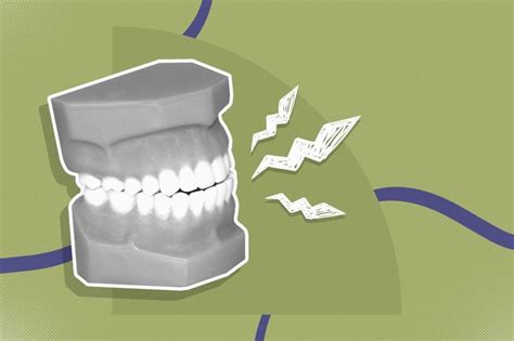 The Effects Of Teeth Grinding And How To Stop Clenching Your Teeth