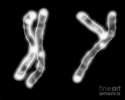 X And Y Chromosomes Concept Photograph By Dept Of Clinical Cytogenetics Addenbrookes Hospital