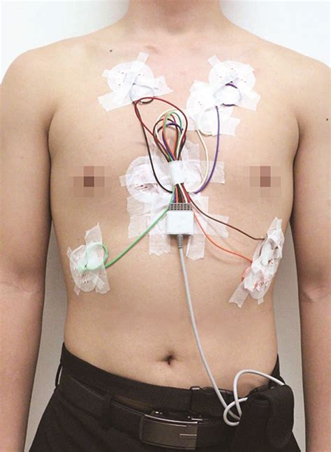 Ambulatory Electrocardiogram Ecg Holter Monitoring Conditions