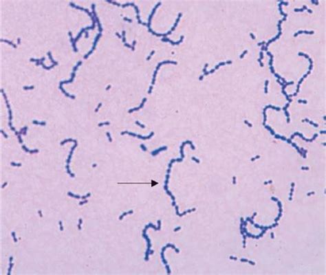 Gram Positive Cocci Review Of Medical Microbiology And Immunology