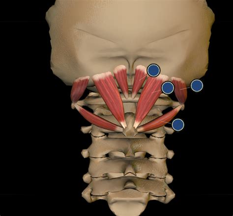 Muscles Of The Suboccipital Triangle Diagram Quizlet