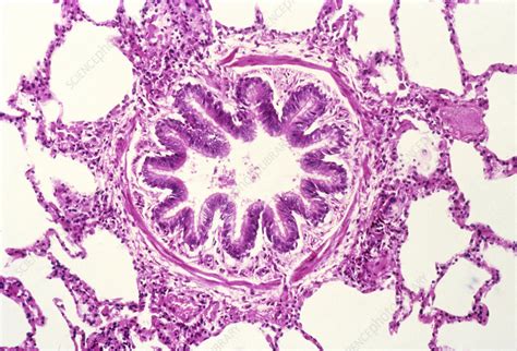 Lm Of A Cross Section Of A Bronchiole And Alveoli Stock Image P590