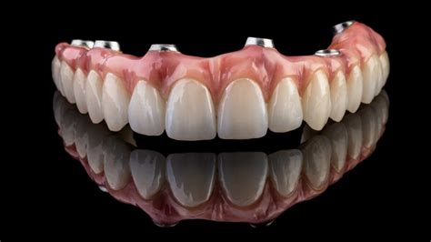 Can Dentures Restore Your Bite Conroe TX