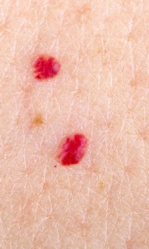 8 Concerning Skin Conditions That Show Up After 40 Easy Health Options®