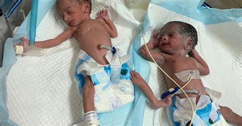 Worlds Oldest Mum 74 Gives Birth To Twins After Ivf And Their Dad