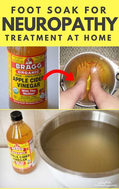 Foot Soak For Neuropathy Treatment At Home V Remedies