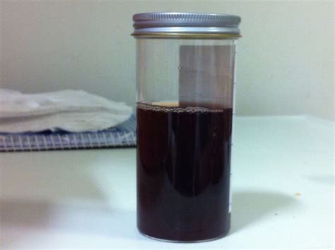A Man With Dark Urine And Shortness Of Breath A Case Based Review Of