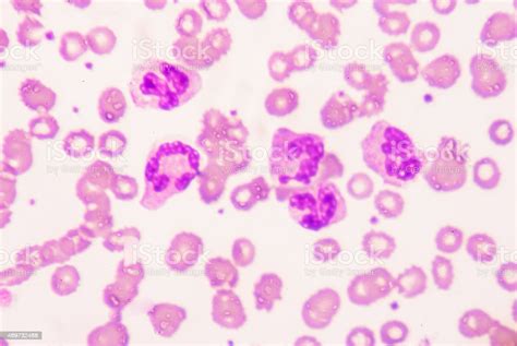 Toxic Granulation Refers To Changes In Granulocyte Cells Seen On Stock