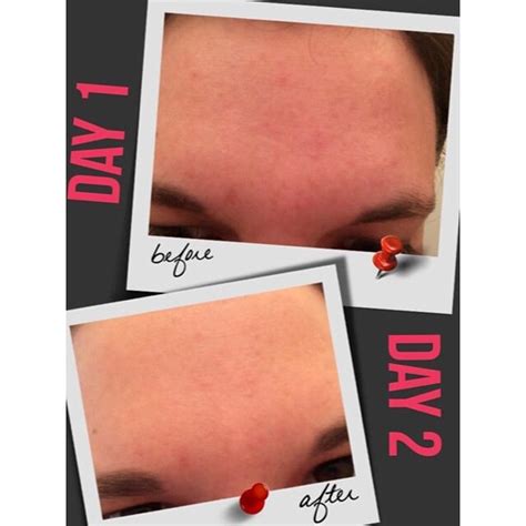 My Nerium Results In One Day Reduced Pores Lines And Redness In My