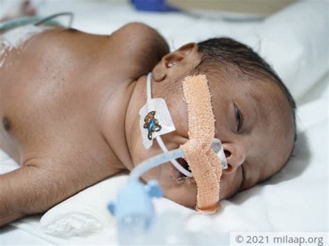 He Is Recovering But His Parents Are Failing To Continue His Treatment