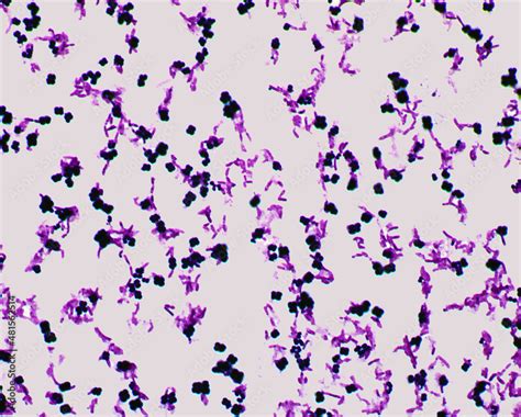 Foto De Gram Staining Of A Mix Of Micrococcus Luteus And Pseudomonas