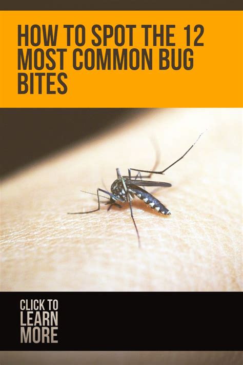 12 Common Bug Bites And How To Recognize Each One Bugs Thing 1 Thing