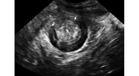 Urogynecology And Pelvic Floor Ultrasound
