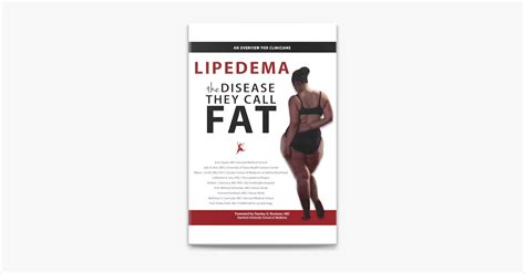 ‎lipedema The Disease They Call Fat An Overview For Clinicians On