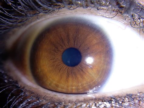 Brown Iris Elena 2015 Iris Iridology Eyes