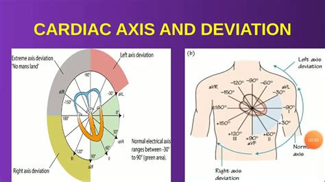 Cardiac Axis And Axis Deviation Explained With Ecg Findings Theme Loader