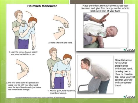 Airway Foreign Body