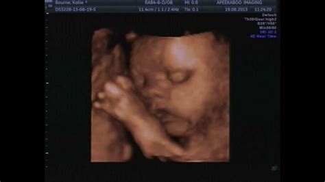 Our Precious Baby Girl 4d Scan At 28 Weeks Youtube