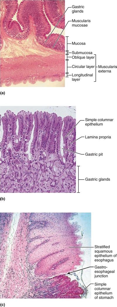 Solved Gastric Glands Muscularis Mucosae Mucosa Submucosa Chegg Com