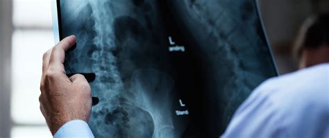 Faqs On Recovery From Minimally Invasive Spine Surgery Neuromicrospine