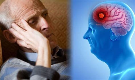 Dementia symptoms: Sign associated with early stage | Express.co.uk