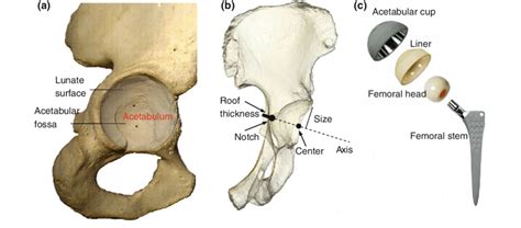 A Morphological Detail Of The Acetabulum In The Pelvic Bone The Download Scientific Diagram